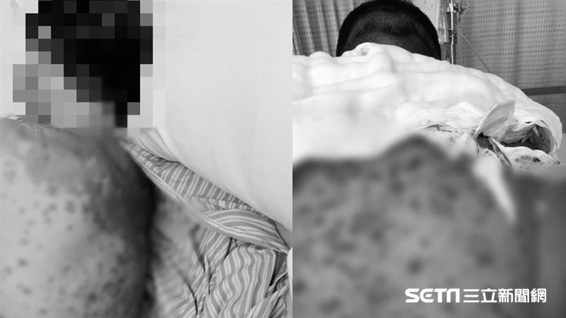 兒染猛病救不回　父曝血淚：別有下個
