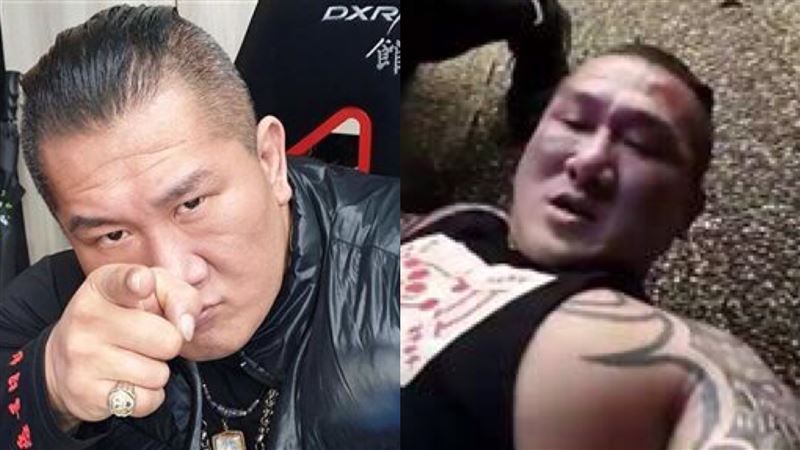 館長遭騷擾中槍　律師曝最強手段處理