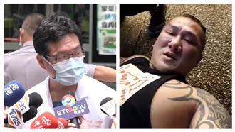 館長手腳中3槍　林口長庚揭最新傷勢