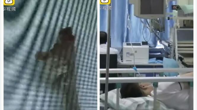 他喝湯「打完嗝胸爆痛」醫：差點沒命