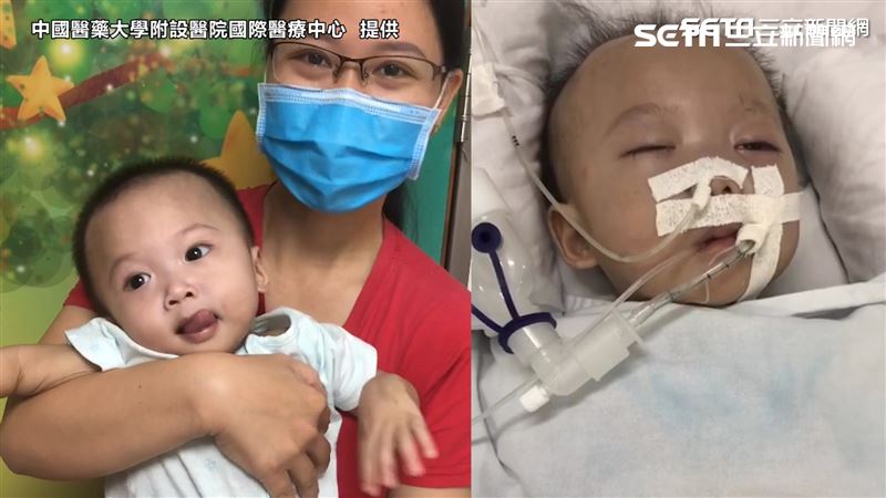 獨／疫情下救援！台醫救活越南重病嬰