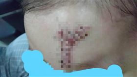 三重,永盛公園,遊樂設施,傷口,縫合（圖／翻攝自臉書社團我是三重人）