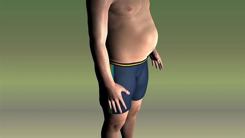 「腹水」堆積小腹凸起　恐為癌症警訊