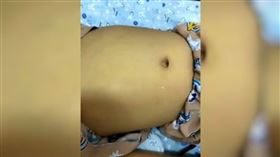 每天喝啤酒！8歲男童1個月後「全身發黃」…險肝衰竭致死（圖／翻攝自看看新聞微博）