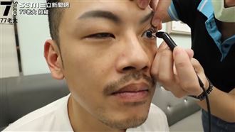 10min掰了近視　男體驗雷射實錄