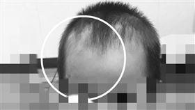 搖錢樹,疤痕,承諾,照片,頭髮,社會,傷疤,模樣,女兒,生父,孩子,女童,南投,台中,