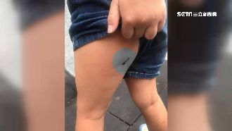 酒瓶被打碎扔地上　男童溜滑梯遭刮傷