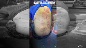 岡山分局,路倒,毆傷,債務糾紛,菸疤,瘀傷,高雄