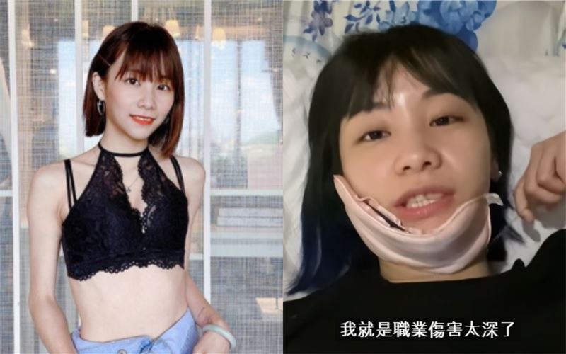 正妹大胃王驚曝職業傷害　無法再大吃