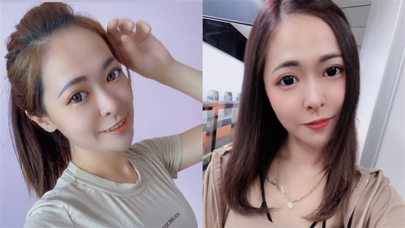 獨／吃鍋炸癱腿丟主持　小模現況曝光