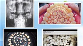（圖／翻攝自Nha Khoa Thế Hệ Mới臉書）