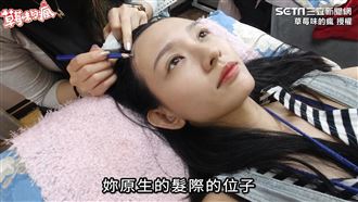 告別高額頭　她體驗仿真毛囊效果驚人