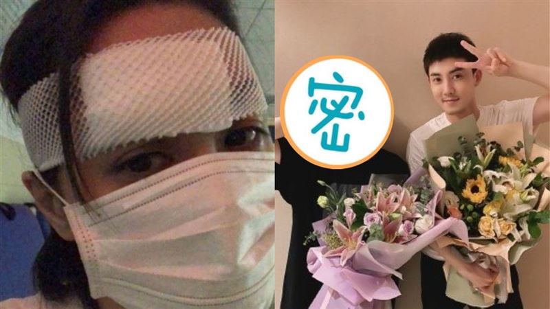 6cm傷口恐破相？阿嬌拆紗布露全臉