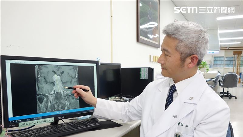 眼尾見「鬼影」…51歲男還不舉1年