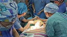 肚裡多一胎！男嬰剛滿月又遭剖腹…「小寶寶」被取出來（圖／翻攝自搜狐新聞）