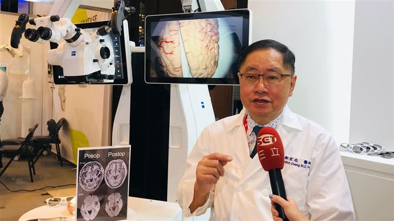 神經外科手術革命　AI進軍醫學中心