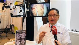 神經外科手術革命　AI進軍醫學中心