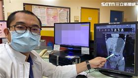 郭敏勇主任筆指處即為十二指腸遭兩動脈夾住阻塞，造成胃與十二指腸嚴重擴張（圖／童綜合醫院提供）