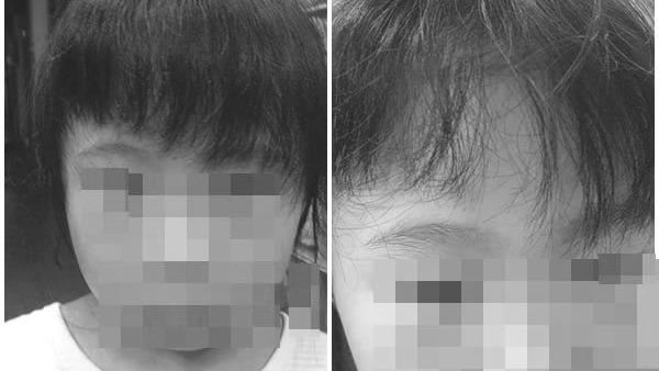 幼兒女「瀏海被亂剪」竟是老師嫌太長
