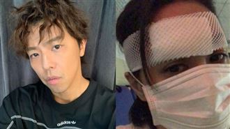 藝人浴室意外頻傳！阿嬌幸運逃死劫