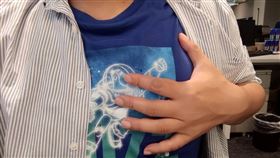 白永嘉,急診醫師的眼睛,胃食道逆流,胸悶,噁心,心肌梗塞,冠動脈阻塞