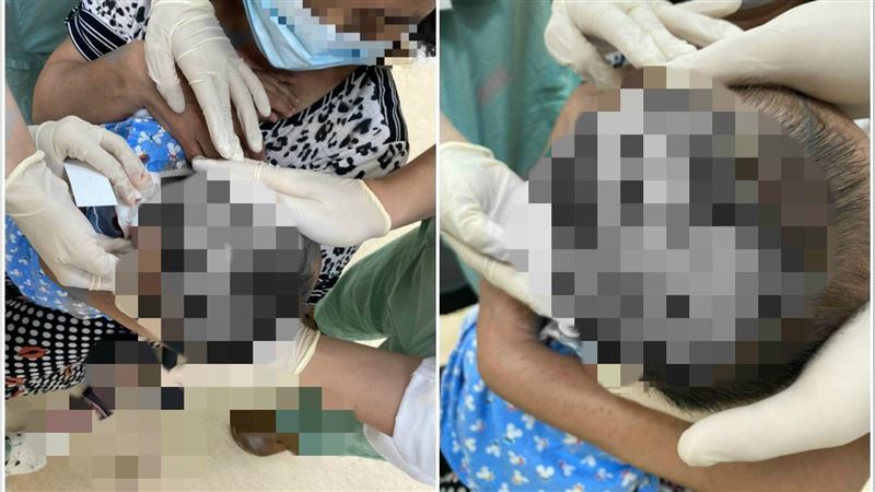 南投1歲童遭米克斯犬狠咬…皮開肉綻
