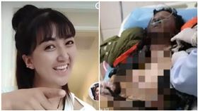 直播開著…前夫潑汽油點火！正妹臉燒焦黑、全身80%燒傷。圖／翻攝自微博