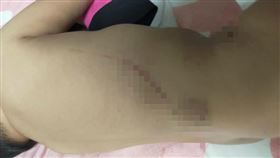 虐童　傷勢（圖／翻攝畫面）