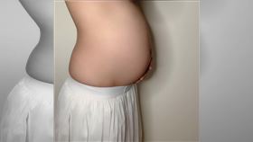 懷孕,摸肚子,臍帶打結,繞頸