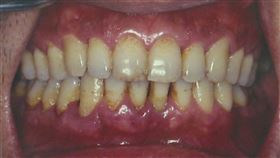 德威國際牙醫醫院提供