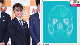 男星長腦腫瘤「比棒球大」（安田章大,傑尼斯,關8
圖翻攝自news every