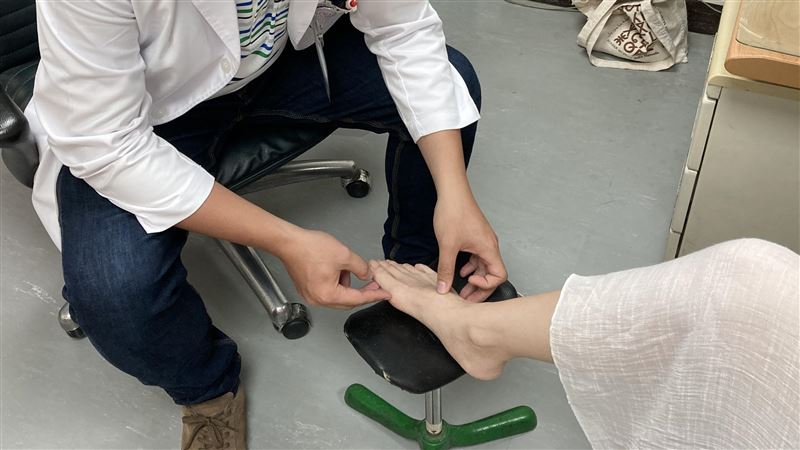 不是高跟鞋的錯！醫揭拇指外翻真相