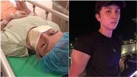 孫安佐,隱疾,開刀,鼻塞。翻攝自yt