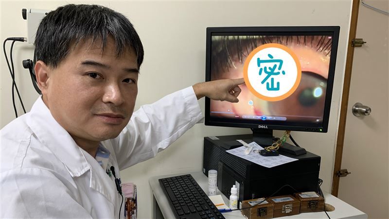 噁！水蛭入侵靈魂之窗　老翁眼睛噴血