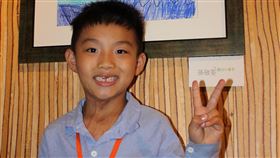 燒傷顏損兒化身小畫家 「彩繪心世界」創作成果今開展
陽光基金會募集燒傷顏損兒生心理重建服務經費
