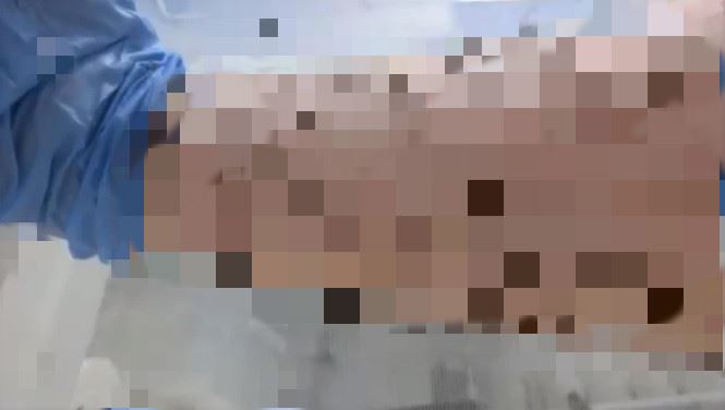 手上停滿5千隻！他曬毛骨悚然實驗照