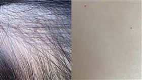 女兒幼稚園回家！媽見「屁股3針眼」…驚老師拿針戳11童（圖／翻攝自微博）