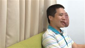 顏面損傷，張育瑄（記者徐翊中攝影）