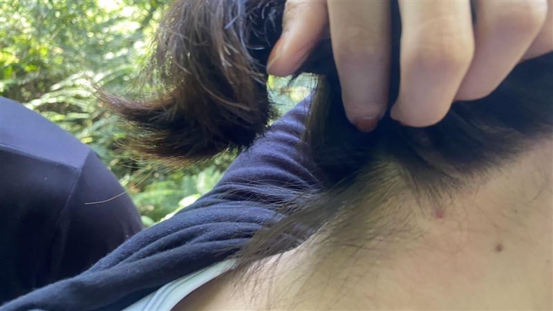 中秋紅河谷踏青　情侶、母女遭蜂螫
