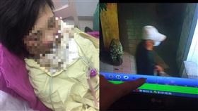 慘遭陌生男潑硫酸！台南正妹「半臉全毀」淚求：幫我抓兇手