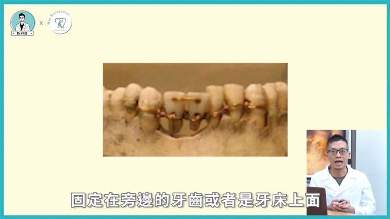 古代人用甚麼當假牙？多數人猜不到！
