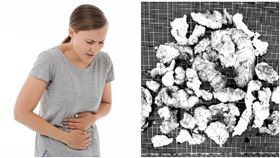 一名53歲婦女，因嚴重腹脹及骨盆壓迫的問題至醫院求診，經檢查後發現子宮有多發性肌瘤。（圖／台南市安南醫院提供）