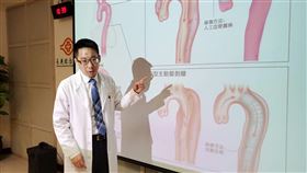 「主動脈剝離有顯著遺傳性」長庚研究登國際重量級期刊(長庚醫院提供)
