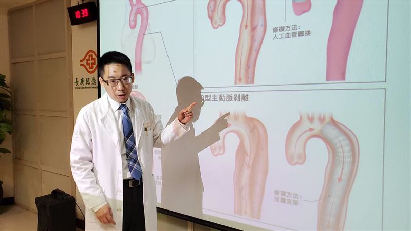 長庚研究躍上國際：主動脈剝離會遺傳