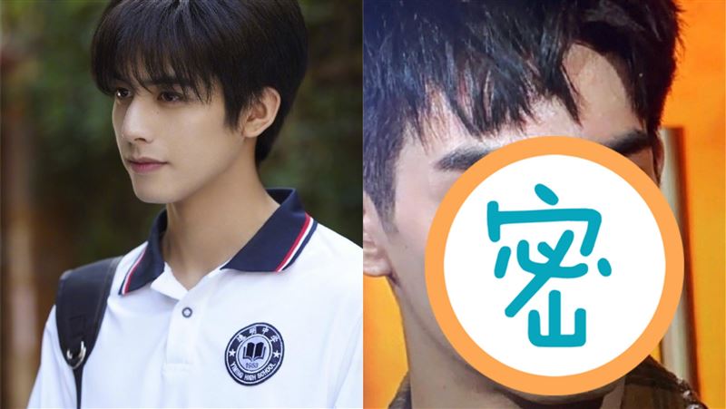 男星下巴額頭狂爆痘　網揭不正常內幕