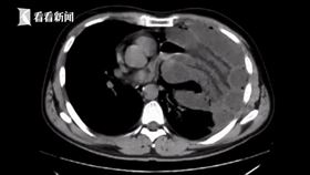 圖／翻攝自看看新聞