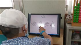 60歲男罹患罕見「他人之手症候群」（南投醫院提供）