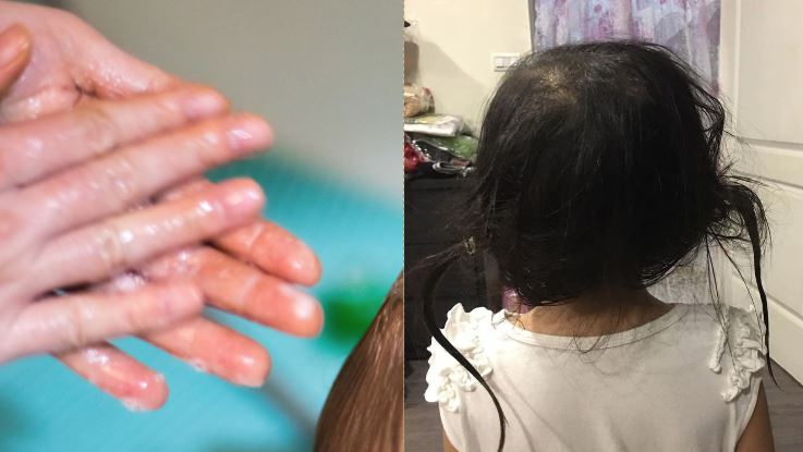尪幫女兒洗頭！妻吐血：橡皮筋都沒拆