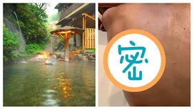 曬傷泡溫泉 (圖／蔡欣妤拍攝