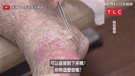 ▼▲李醫師也無法找出病因。（圖／來源 TLC 旅遊生活頻道）